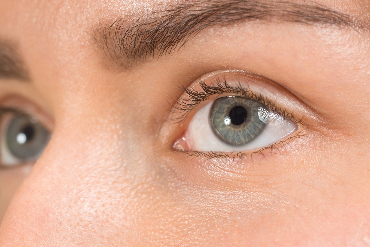 Dilated Pupils (Mydriasis): What Is It, Causes & What It Looks Like