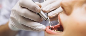 Dry Socket As A Complication Of Permanent Tooth Extraction