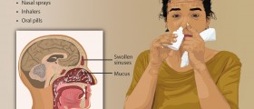Excessive Mucous Production : Causes, Diagnosis And Treatment
