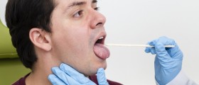 Geographic Tongue
