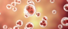 Guillain-Barré Syndrome (GBS) and Its Treatment