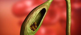 How to Deal with Pain After Gallbladder Surgery