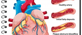 How to Interpret Coronary Artery Blockage