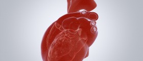 How to Manage Your Aortic Dissection