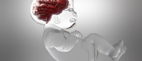 Hydrocephalus In Infants and Adults: Treatment Options