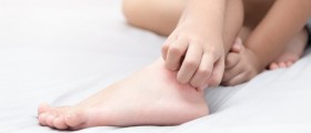 Inflammatory Changes On The Lower Legs