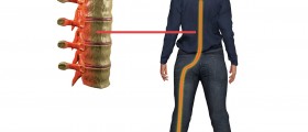 Is There Such A Thing As An Extra Lumbar Vertebra?