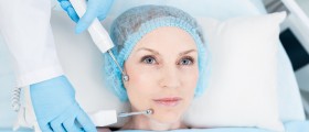 Lifestyle Lift: Procedure, Results, And Possible Complications