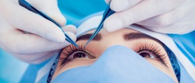 Light Sensitivity After Cataract Surgery