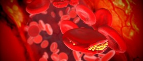 Lowering Cholesterol: What You Need To Know