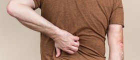Lumps and Bumps on Your Back: When You Should Worry