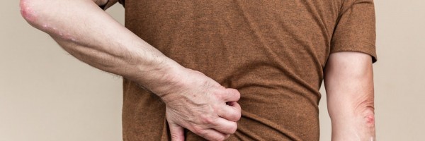 Lumps and Bumps on Your Back: When You Should Worry