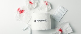Non-Surgical Treatment For Hemorrhoids