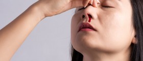 Nosebleeds And The Menstrual Cycle