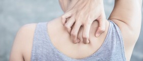 Notalgia Paresthetica: Unexplained Upper-Back Itching Explained