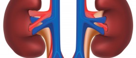 Nutcracker Syndrome: Diagnosis, Symptoms and Treatment