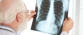 Outpatient Pneumonia: Community Acquired Pneumonia