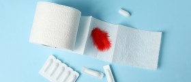 Painless Rectal Bleeding Is Alarming