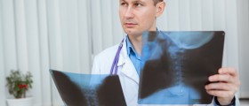 Possible Complaints After Neck Fusion Surgery