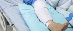 Post ACL (Anterior Cruciate Ligament) Surgery Complications