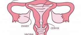 Potential Complications Following Endometrial Ablation