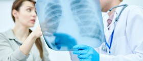 Pulmonary Tuberculosis