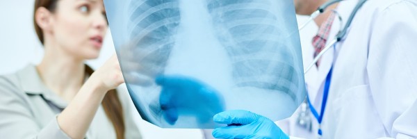 Pulmonary Tuberculosis