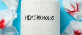 Recovery After Hemorrhoidectomy May Take Some Time