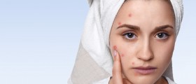 Red Sore Bumps On Face - Are They Acne?
