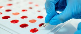 Rh Negative Blood And Pregnancy Complications