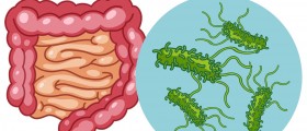 Salmonella Food Poisoning: What Do You Need To Know?