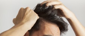 Seborrheic Dermatitis Treatment
