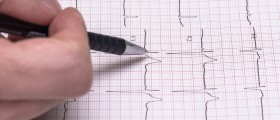 Sudden Tachycardia Has Numerous Causes