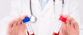 Symptoms And Signs Of HIV Infection