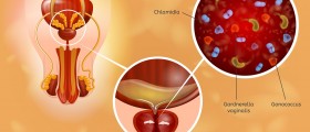 Treatment Of Chlamydia