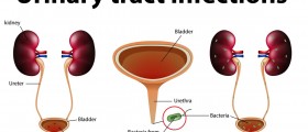 Urinary Tract Infections: Symptoms, Diagnosis And Treatment