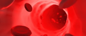 Vaculitis: What It Is, What to Do About It
