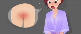 Vulvovaginitis: Causes Of Severely Swollen, Painful, Inflamed And Itchy Vulva And Vaginal Area