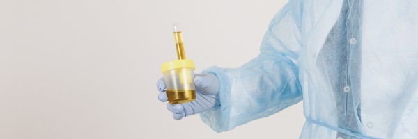 What Causes Mucus In The Urine?