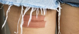 What Causes Pain In The Back Of The Upper Thigh?