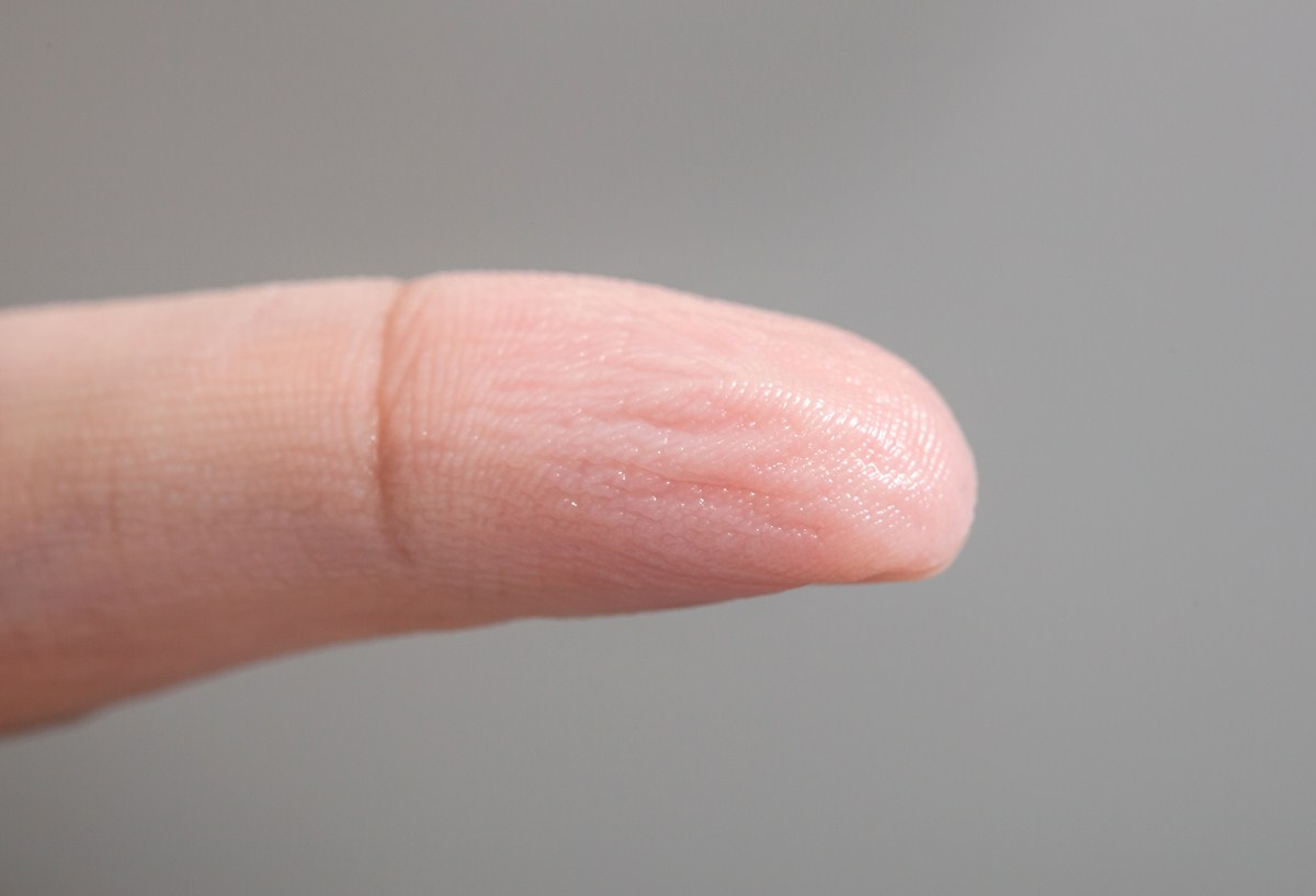 what-causes-peeling-skin-on-the-fingertips-skin-hair-problems