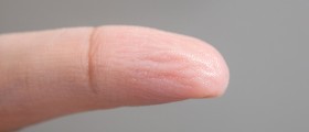 What Causes Peeling Skin On The Fingertips?