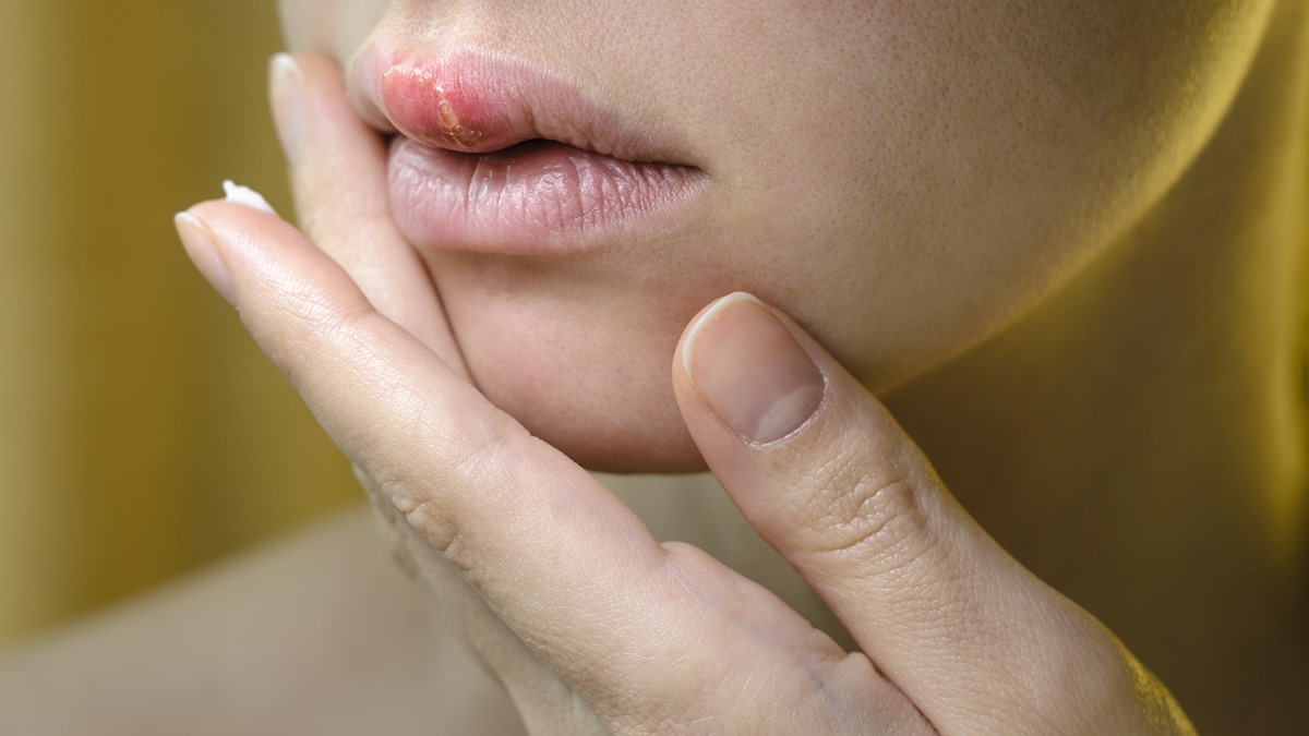 what-causes-swollen-lips-skin-hair-problems-medical-answers-body