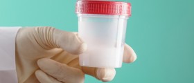 What Do Pus Cells (White Blood Cells) In The Semen Mean And What To Do About Them?