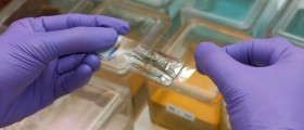 What Does A Painful Pap Smear Mean?