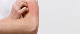 What Is Aquagenic Pruritus?