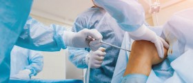 What Is Arthroscopy With Lateral Release?