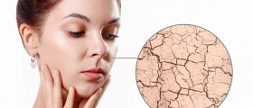 What to Do About Spider Veins and Broken Blood Vessels in the Face