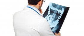 What To Expect After A Bowel Resection Surgery?