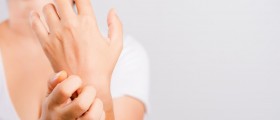 What You Need To Know About Hand Eczema